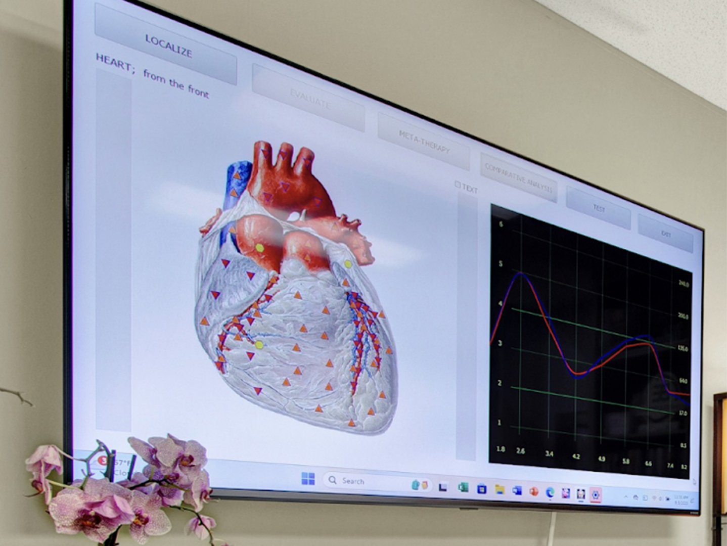 Medical presentation with heart diagram